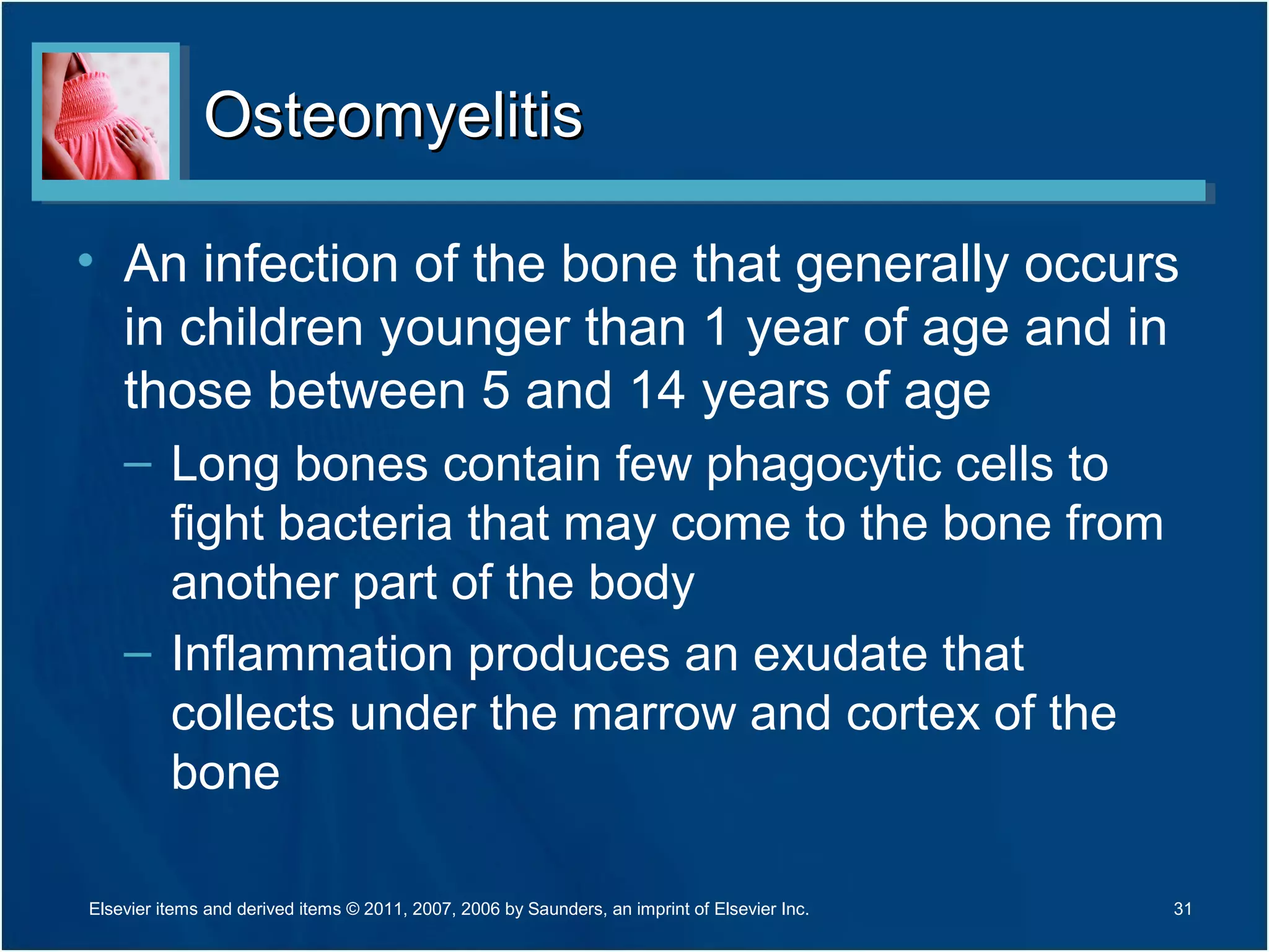 OsteomyelitisOsteomyelitis
• An infection of the bone that generally occurs
in children younger than 1 year of age and in
those between 5 and 14 years of age
– Long bones contain few phagocytic cells to
fight bacteria that may come to the bone from
another part of the body
– Inflammation produces an exudate that
collects under the marrow and cortex of the
bone
31Elsevier items and derived items © 2011, 2007, 2006 by Saunders, an imprint of Elsevier Inc.
 