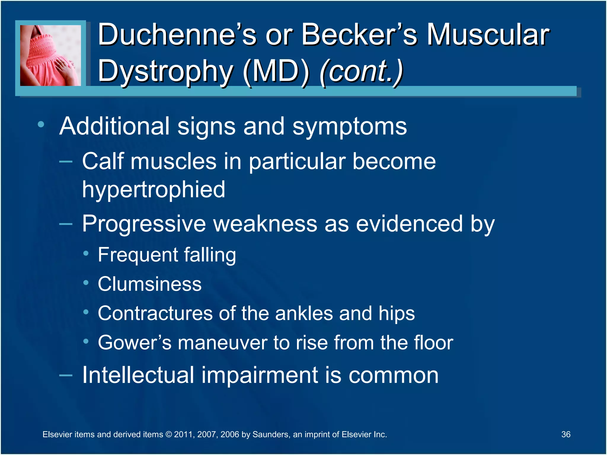 Duchenne’s or Becker’s MuscularDuchenne’s or Becker’s Muscular
Dystrophy (MD)Dystrophy (MD) (cont.)(cont.)
• Additional signs and symptoms
– Calf muscles in particular become
hypertrophied
– Progressive weakness as evidenced by
• Frequent falling
• Clumsiness
• Contractures of the ankles and hips
• Gower’s maneuver to rise from the floor
– Intellectual impairment is common
36Elsevier items and derived items © 2011, 2007, 2006 by Saunders, an imprint of Elsevier Inc.
 