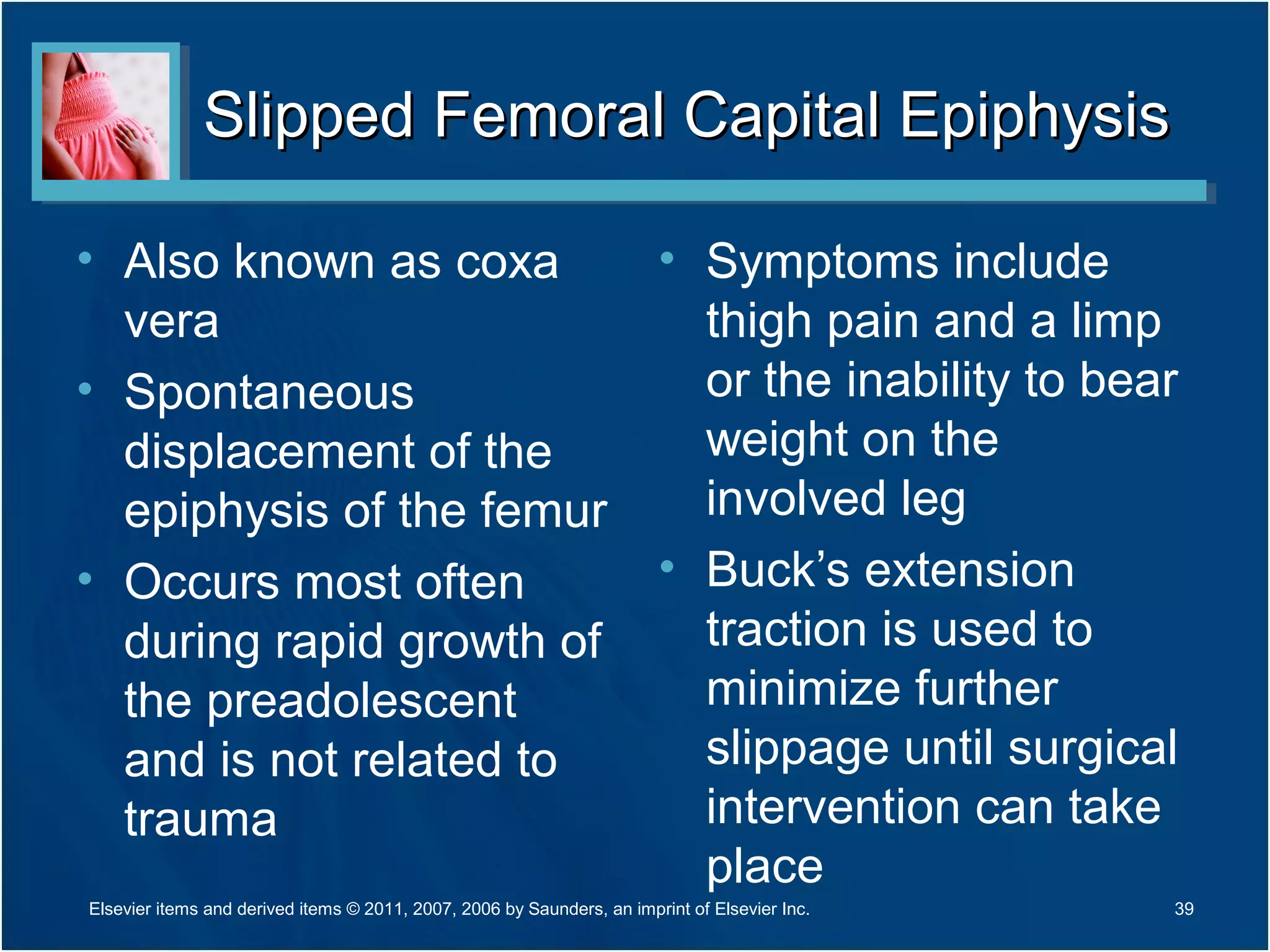 Slipped Femoral Capital EpiphysisSlipped Femoral Capital Epiphysis
• Also known as coxa
vera
• Spontaneous
displacement of the
epiphysis of the femur
• Occurs most often
during rapid growth of
the preadolescent
and is not related to
trauma
• Symptoms include
thigh pain and a limp
or the inability to bear
weight on the
involved leg
• Buck’s extension
traction is used to
minimize further
slippage until surgical
intervention can take
place
Elsevier items and derived items © 2011, 2007, 2006 by Saunders, an imprint of Elsevier Inc. 39
 
