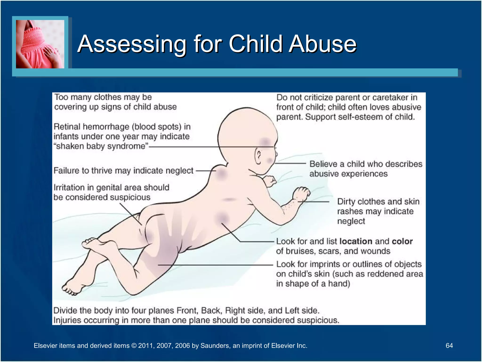 Assessing for Child AbuseAssessing for Child Abuse
64Elsevier items and derived items © 2011, 2007, 2006 by Saunders, an imprint of Elsevier Inc.
 