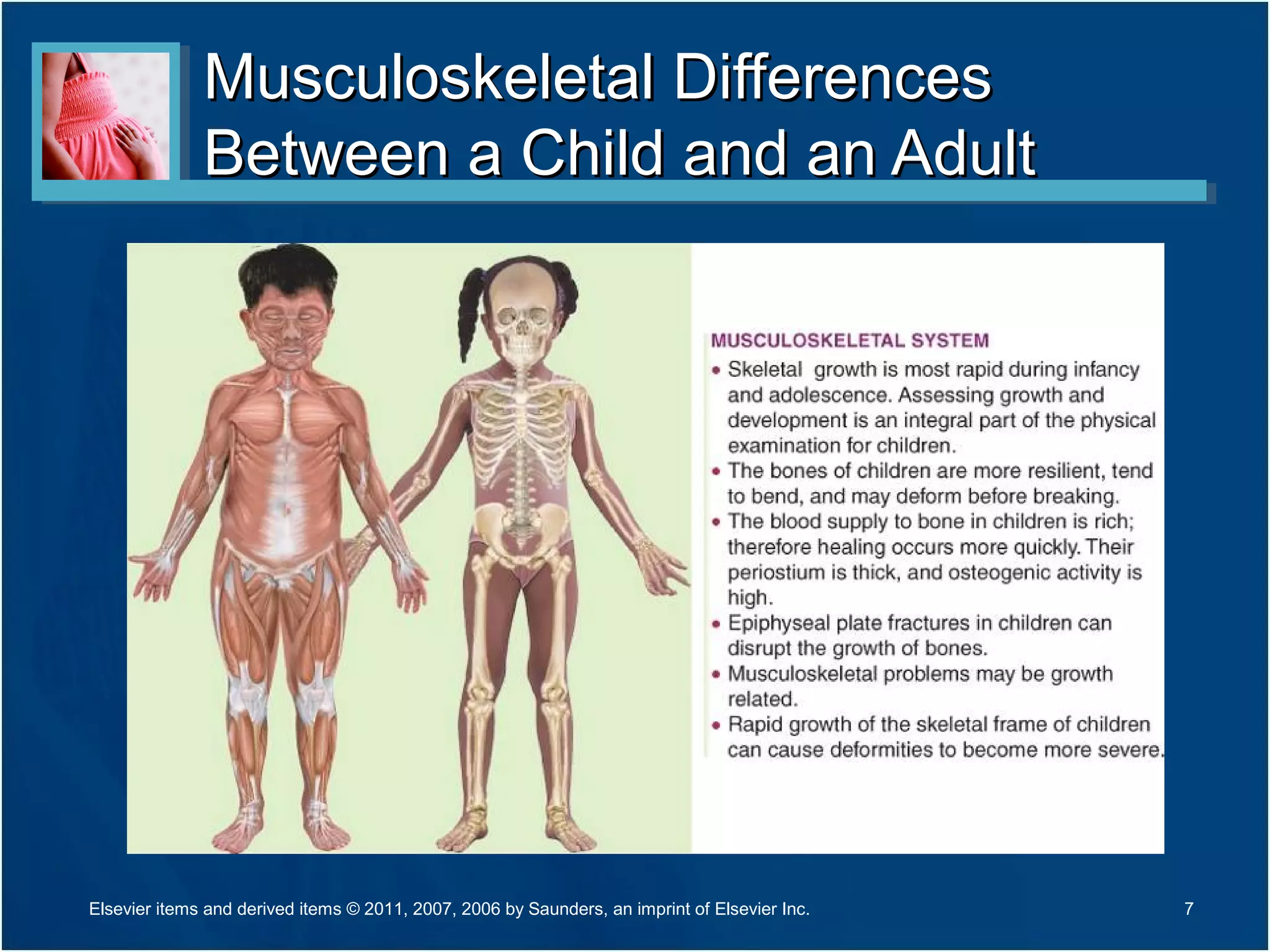 Musculoskeletal DifferencesMusculoskeletal Differences
Between a Child and an AdultBetween a Child and an Adult
7Elsevier items and derived items © 2011, 2007, 2006 by Saunders, an imprint of Elsevier Inc.
 