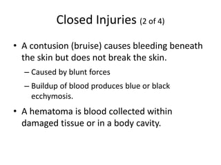 Closed Injuries (2 of 4)
• A contusion (bruise) causes bleeding beneath
the skin but does not break the skin.
– Caused by blunt forces
– Buildup of blood produces blue or black
ecchymosis.
• A hematoma is blood collected within
damaged tissue or in a body cavity.
 