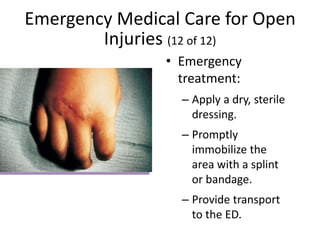 Emergency Medical Care for Open
Injuries (12 of 12)
• Emergency
treatment:
– Apply a dry, sterile
dressing.
– Promptly
immobilize the
area with a splint
or bandage.
– Provide transport
to the ED.
 