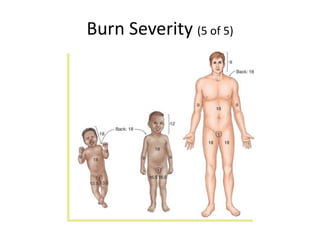 Burn Severity (5 of 5)
 