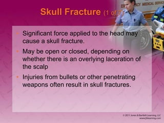 Skull Potential Injuries Chapter_26 Nervous System Parts and Functions .ppt