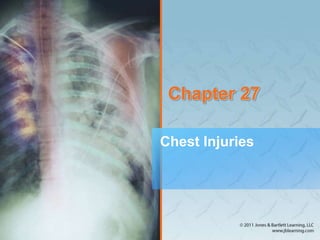 Chapter 27
Chest Injuries
 