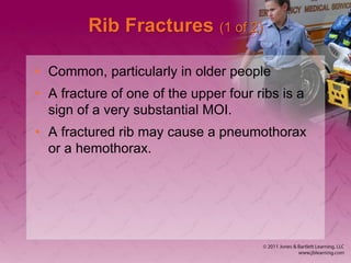 Particularly Ribs Chapter_27.ppt