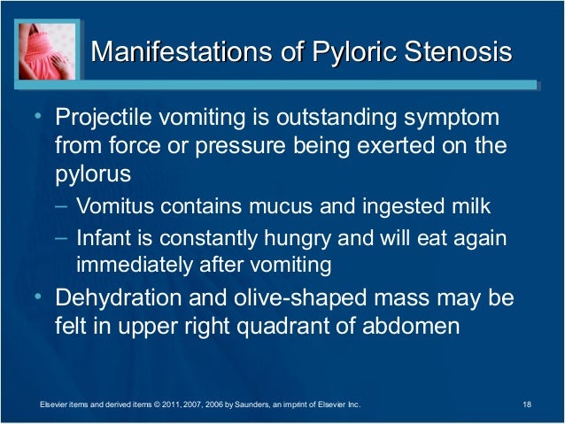 Chapter 28 Power Point