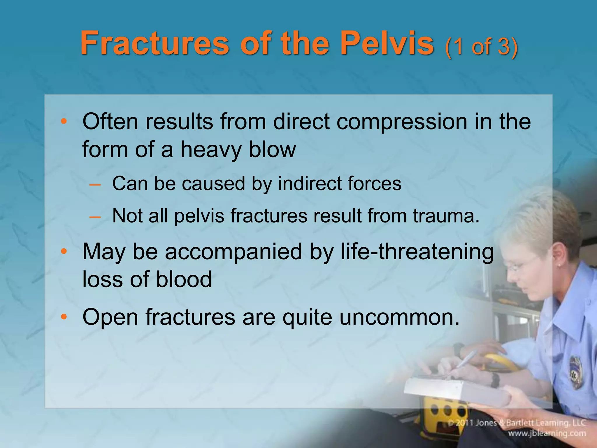 Fractures of the Pelvis (1 of 3)
• Often results from direct compression in the
form of a heavy blow
– Can be caused by indirect forces
– Not all pelvis fractures result from trauma.
• May be accompanied by life-threatening
loss of blood
• Open fractures are quite uncommon.
 