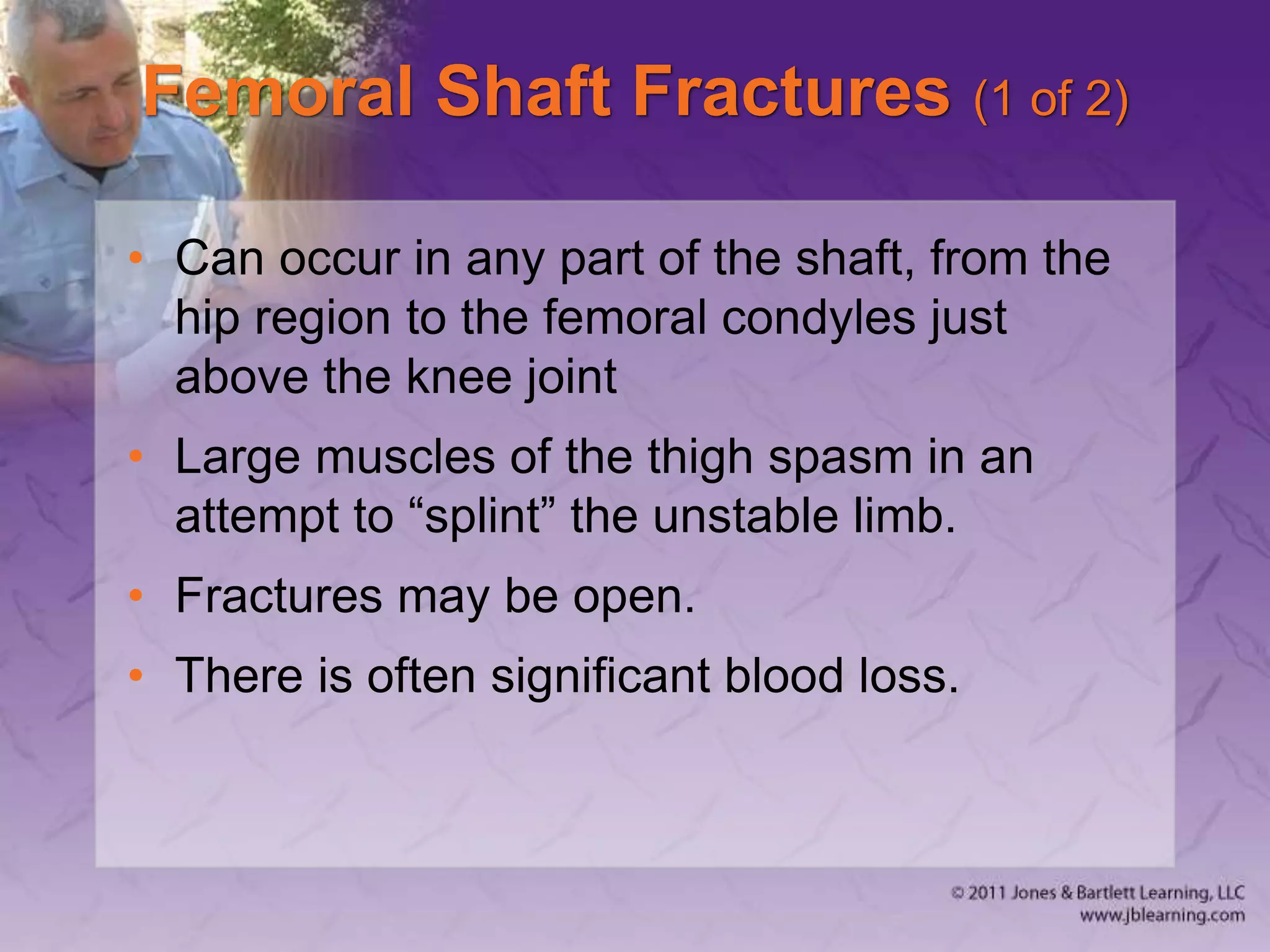 Femoral Shaft Fractures (1 of 2)
• Can occur in any part of the shaft, from the
hip region to the femoral condyles just
above the knee joint
• Large muscles of the thigh spasm in an
attempt to “splint” the unstable limb.
• Fractures may be open.
• There is often significant blood loss.
 