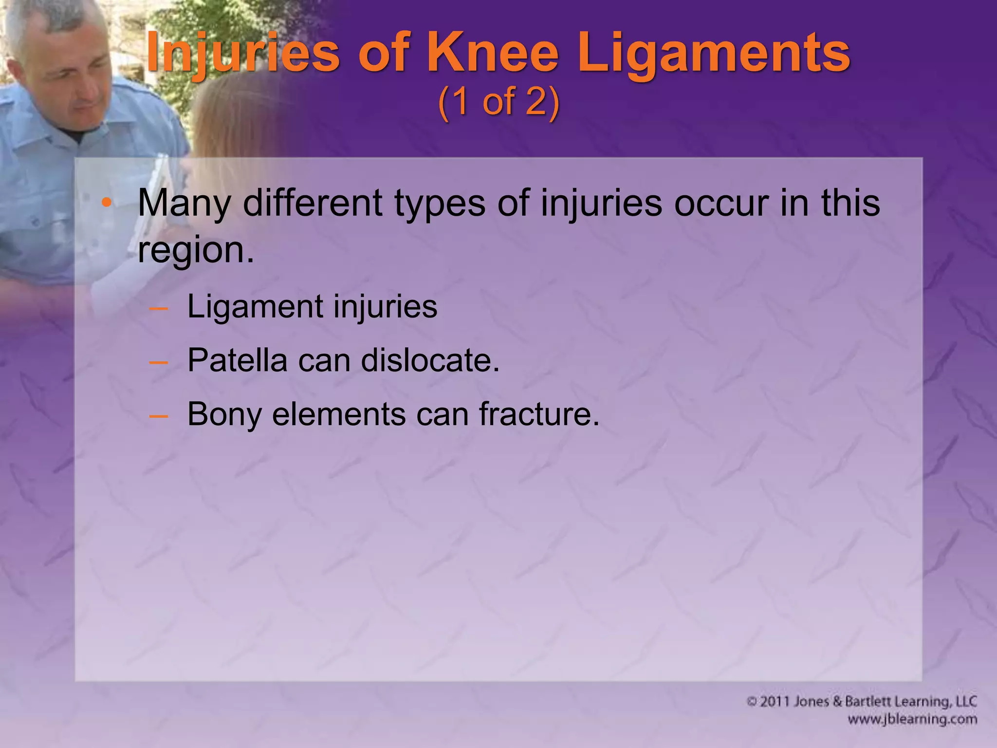 Injuries of Knee Ligaments
(1 of 2)
• Many different types of injuries occur in this
region.
– Ligament injuries
– Patella can dislocate.
– Bony elements can fracture.
 