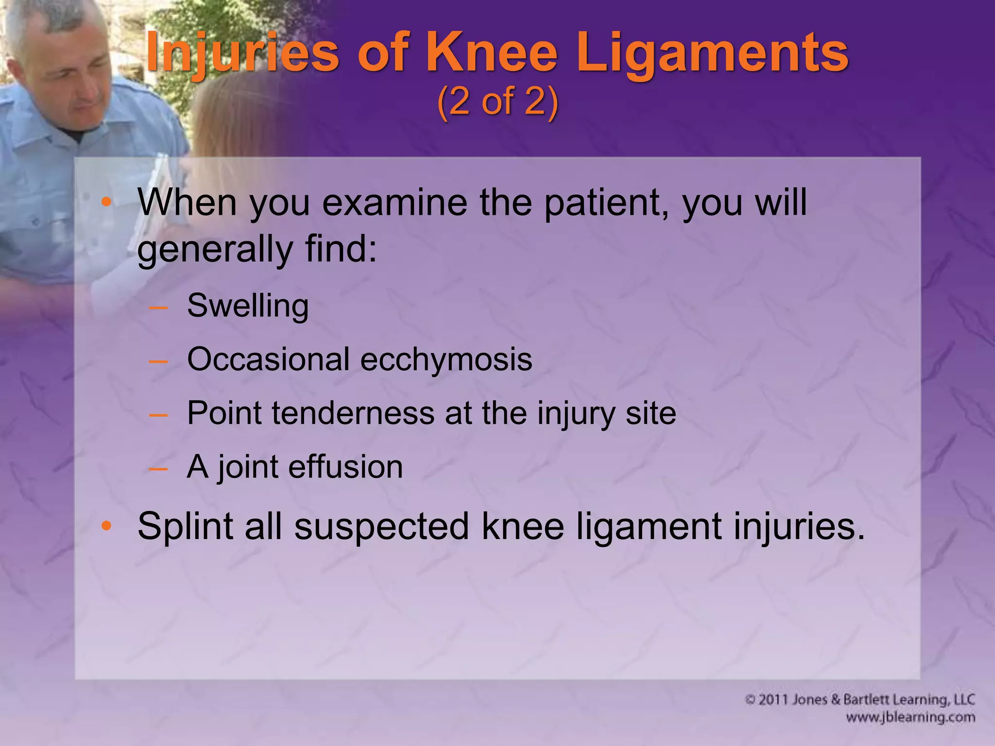 Injuries of Knee Ligaments
(2 of 2)
• When you examine the patient, you will
generally find:
– Swelling
– Occasional ecchymosis
– Point tenderness at the injury site
– A joint effusion
• Splint all suspected knee ligament injuries.
 