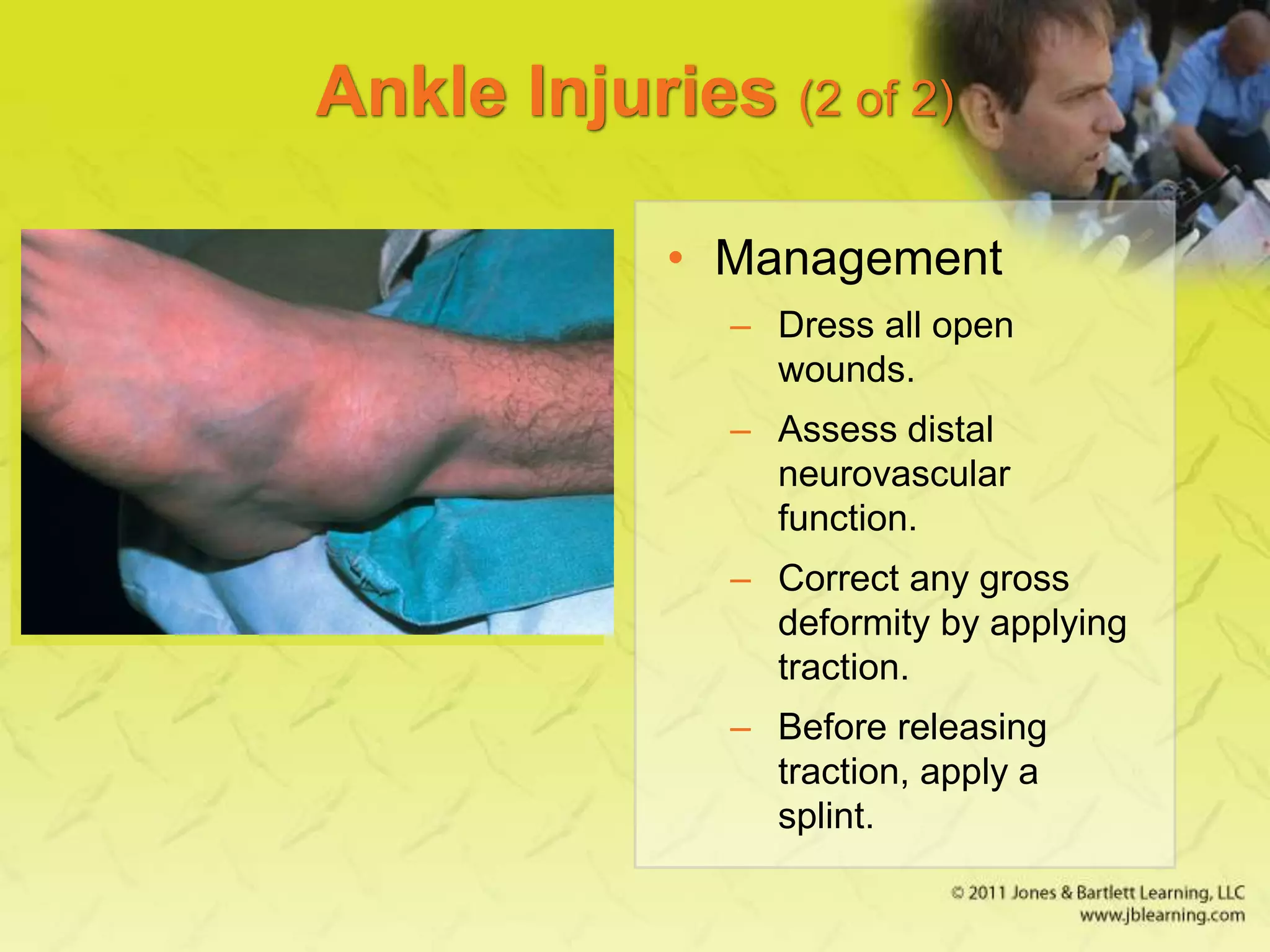 Ankle Injuries (2 of 2)
• Management
– Dress all open
wounds.
– Assess distal
neurovascular
function.
– Correct any gross
deformity by applying
traction.
– Before releasing
traction, apply a
splint.
 