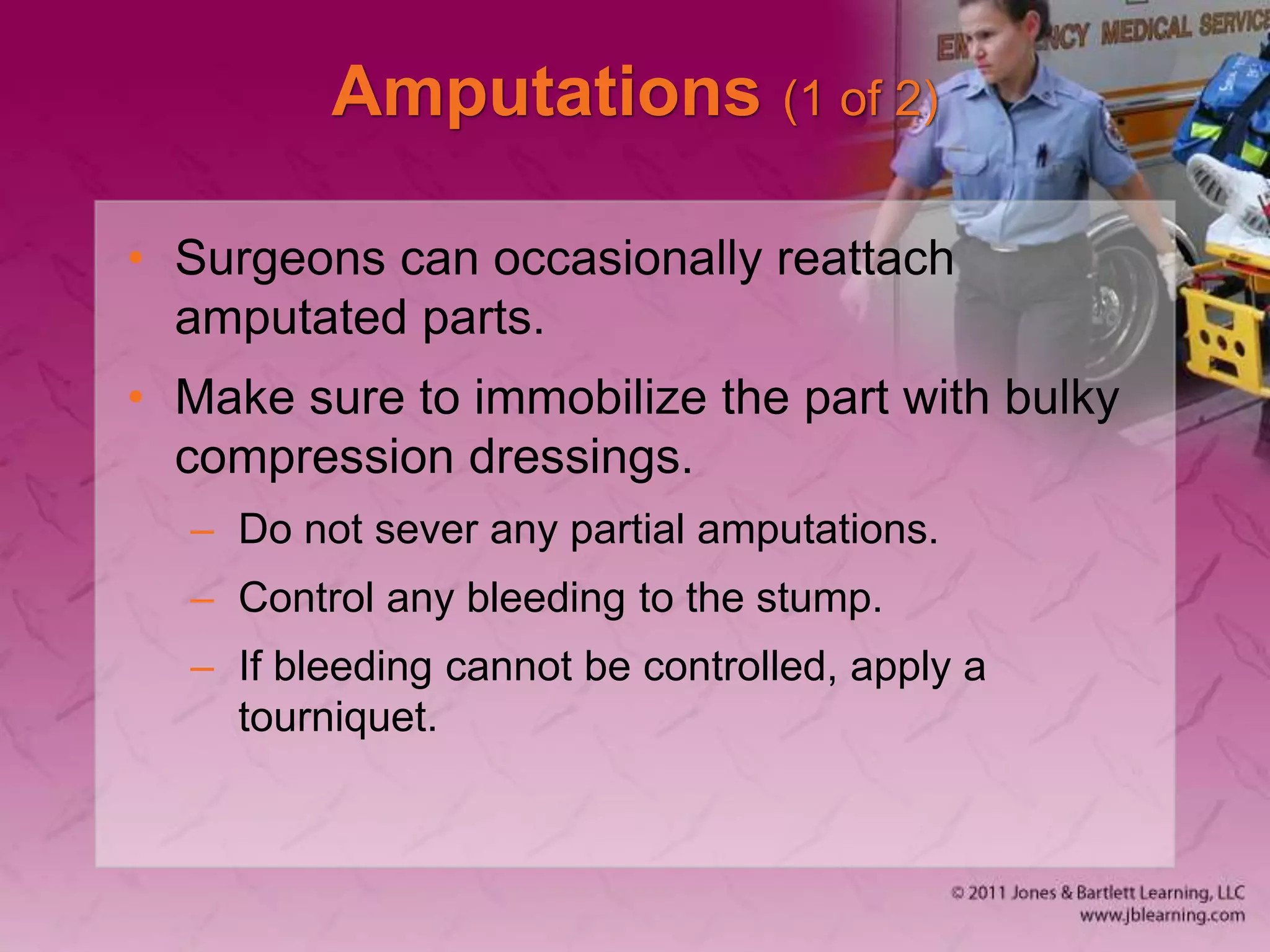 Amputations (1 of 2)
• Surgeons can occasionally reattach
amputated parts.
• Make sure to immobilize the part with bulky
compression dressings.
– Do not sever any partial amputations.
– Control any bleeding to the stump.
– If bleeding cannot be controlled, apply a
tourniquet.
 