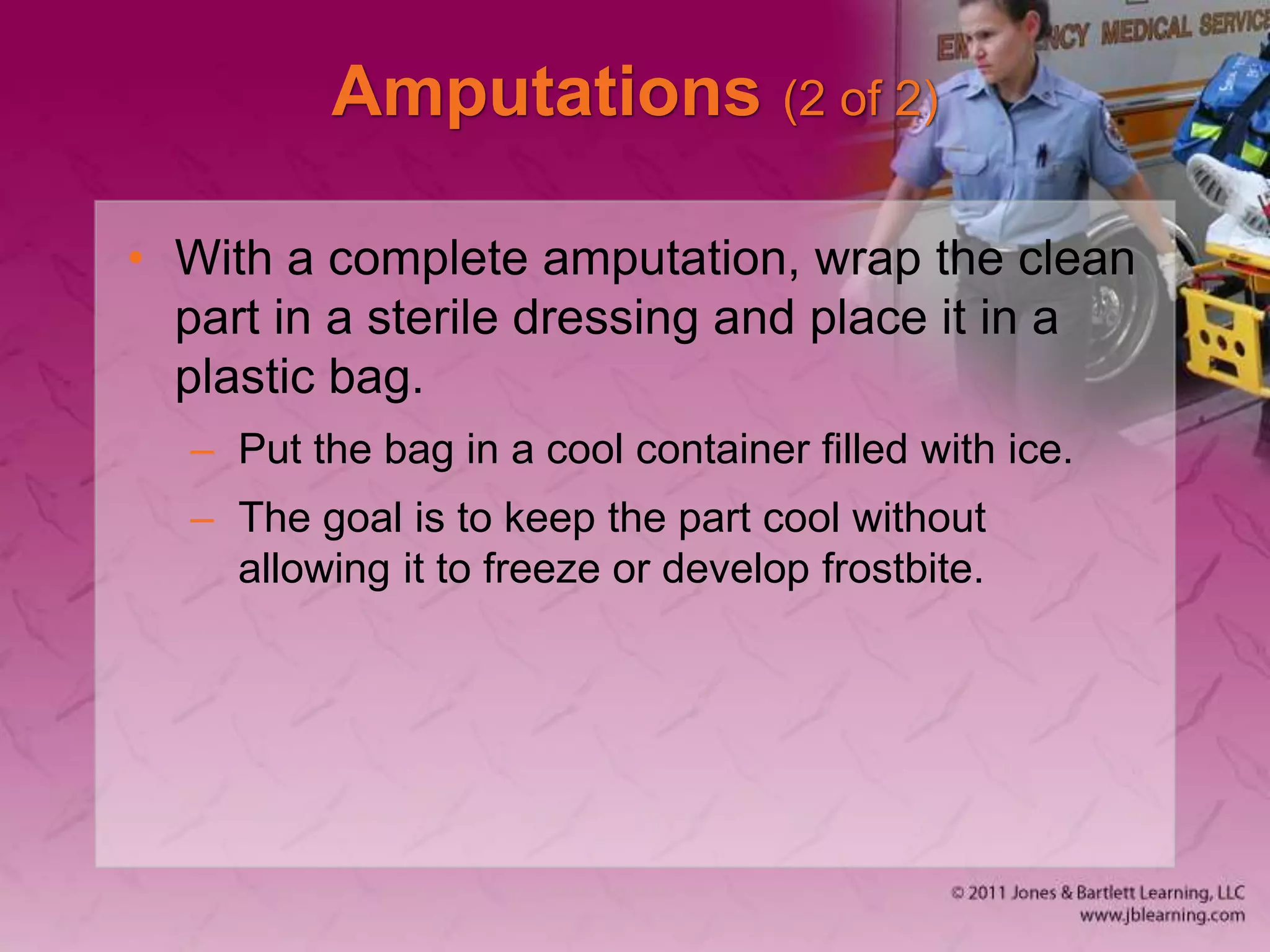 Amputations (2 of 2)
• With a complete amputation, wrap the clean
part in a sterile dressing and place it in a
plastic bag.
– Put the bag in a cool container filled with ice.
– The goal is to keep the part cool without
allowing it to freeze or develop frostbite.
 