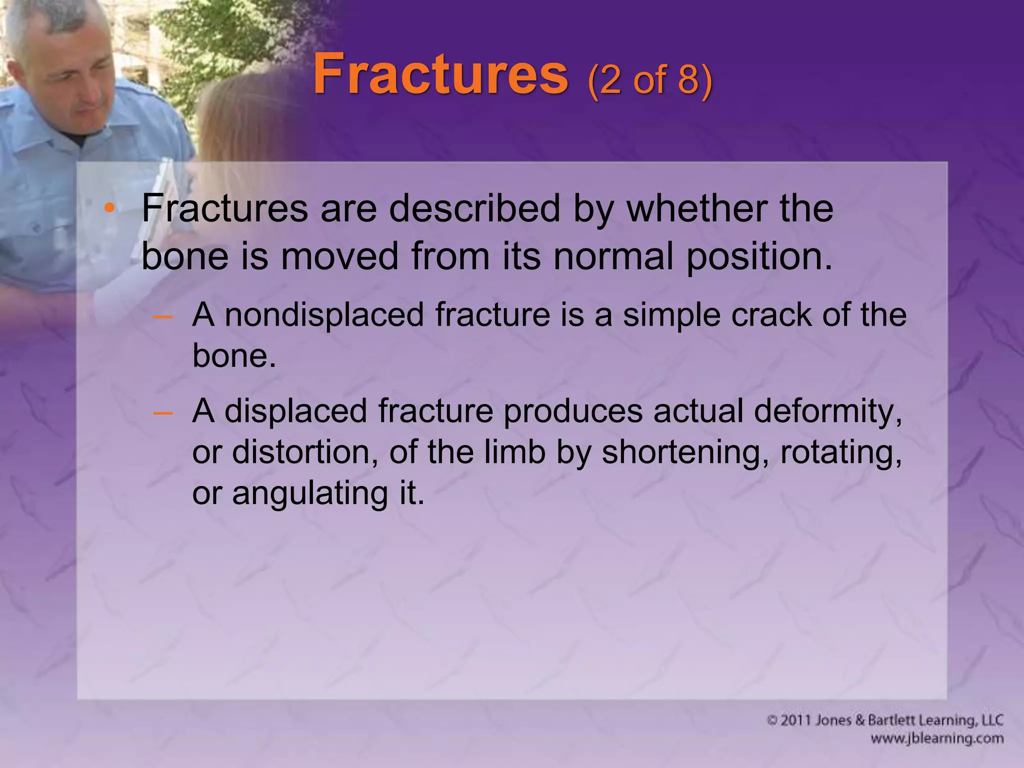 Fractures (2 of 8)
• Fractures are described by whether the
bone is moved from its normal position.
– A nondisplaced fracture is a simple crack of the
bone.
– A displaced fracture produces actual deformity,
or distortion, of the limb by shortening, rotating,
or angulating it.
 