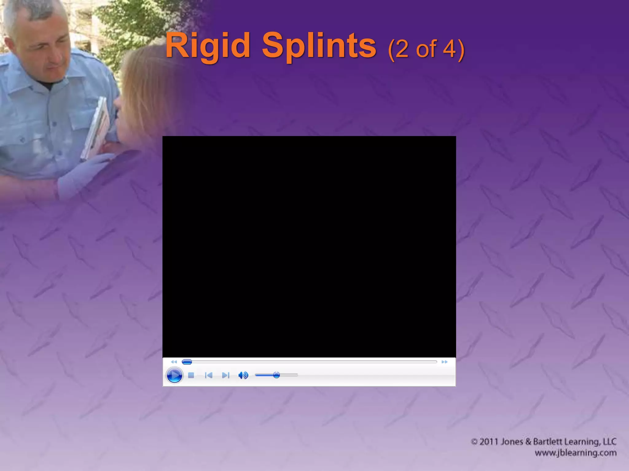 Rigid Splints (2 of 4)
 