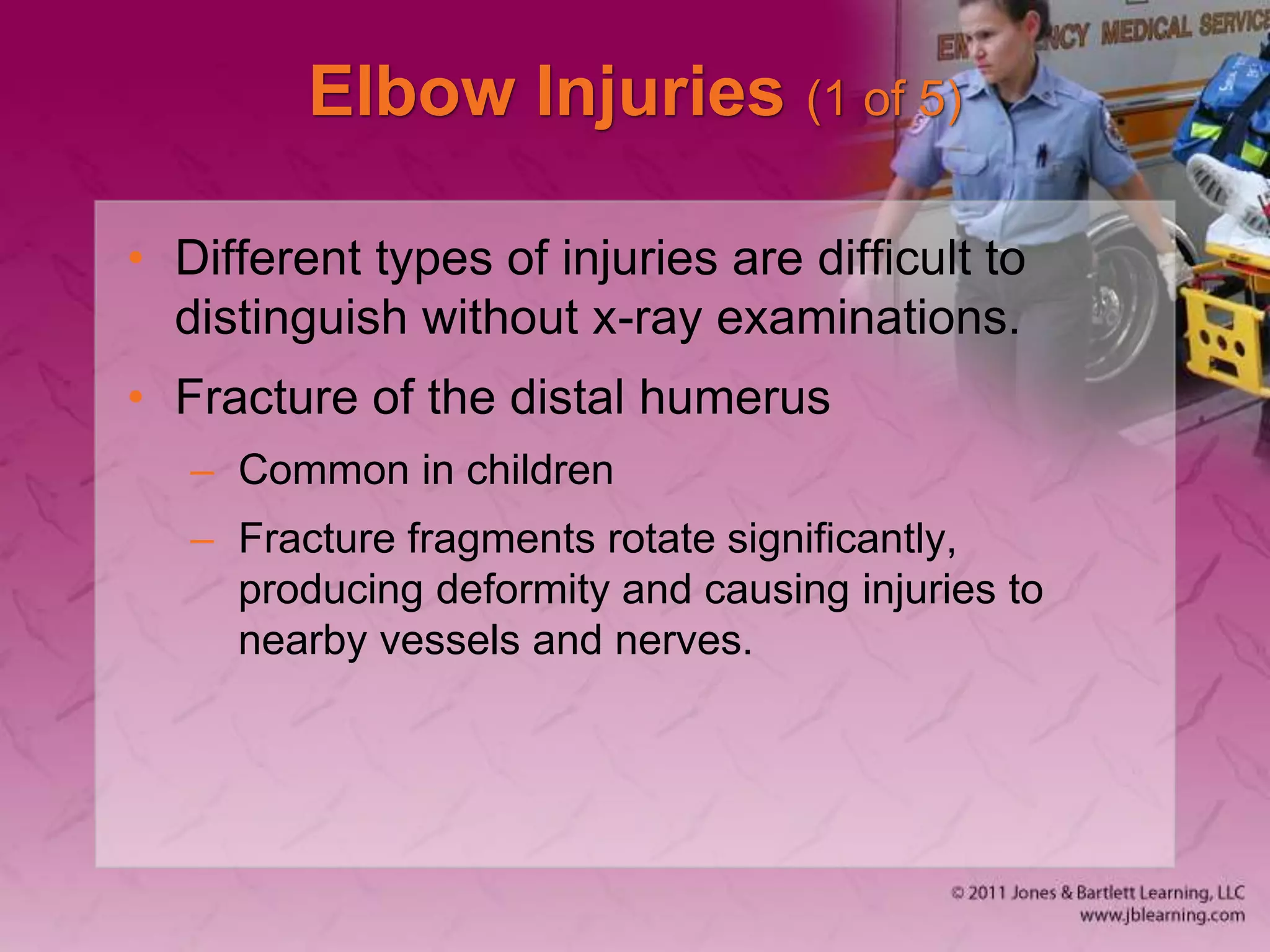 Elbow Injuries (1 of 5)
• Different types of injuries are difficult to
distinguish without x-ray examinations.
• Fracture of the distal humerus
– Common in children
– Fracture fragments rotate significantly,
producing deformity and causing injuries to
nearby vessels and nerves.
 