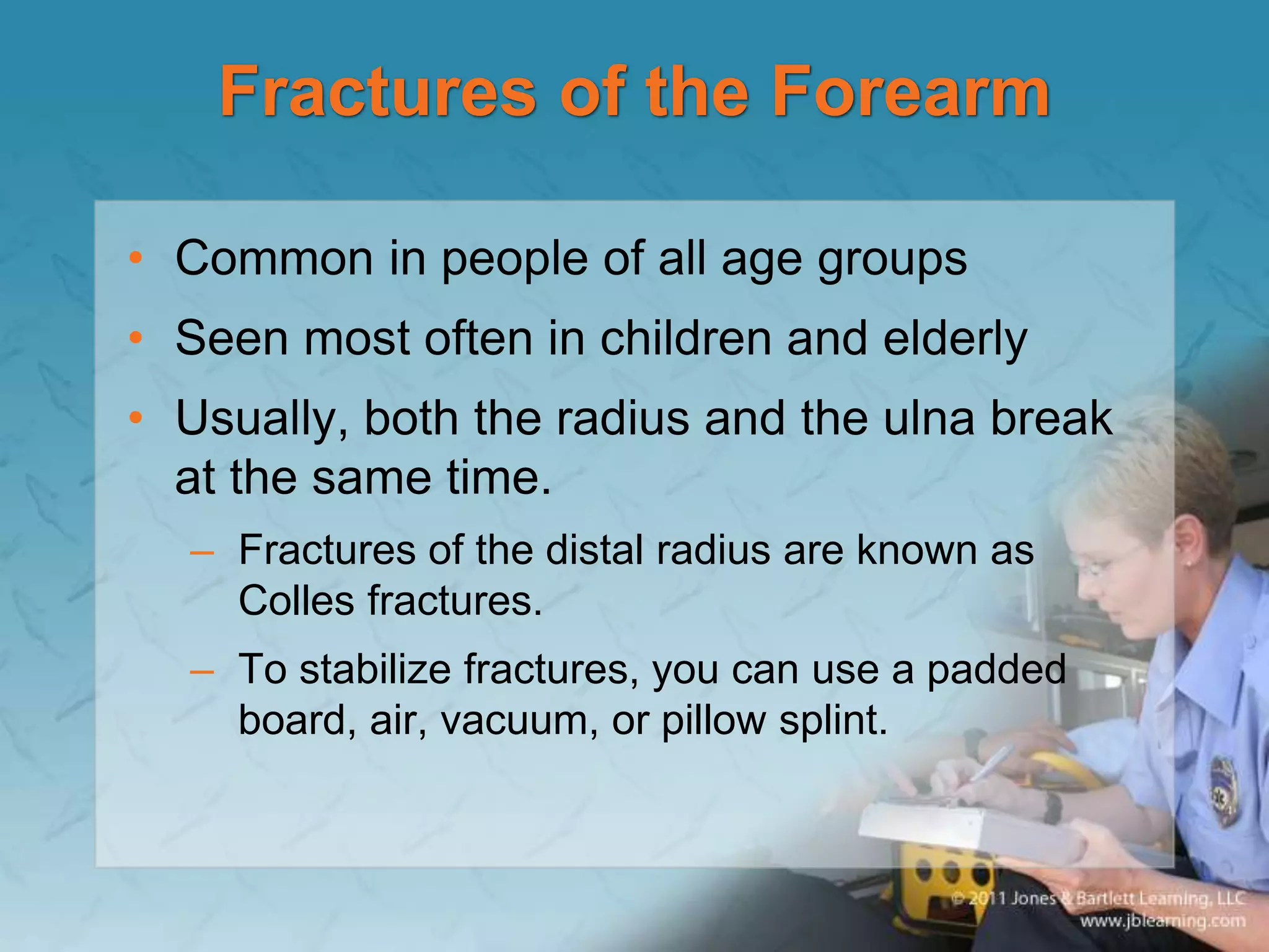 Fractures of the Forearm
• Common in people of all age groups
• Seen most often in children and elderly
• Usually, both the radius and the ulna break
at the same time.
– Fractures of the distal radius are known as
Colles fractures.
– To stabilize fractures, you can use a padded
board, air, vacuum, or pillow splint.
 