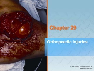 Chapter 29
Orthopaedic Injuries
 