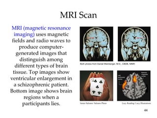 MRI Scan MRI (magnetic resonance imaging)  uses magnetic fields and radio waves to produce computer-generated images that distinguish among different types of brain tissue. Top images show ventricular enlargement in a schizophrenic patient. Bottom image shows brain regions when a participants lies. Both photos from Daniel Weinberger, M.D., CBDB, NIMH James Salzano/ Salzano Photo Lucy Reading/ Lucy Illustrations 