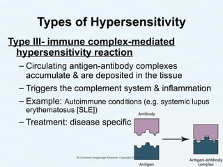 Types of Hypersensitivity
Type III- immune complex-mediated
hypersensitivity reaction
– Circulating antigen-antibody complexes
accumulate & are deposited in the tissue
– Triggers the complement system & inflammation
– Example: Autoimmune conditions (e.g. systemic lupus
erythematosus [SLE])
– Treatment: disease specific
23
 