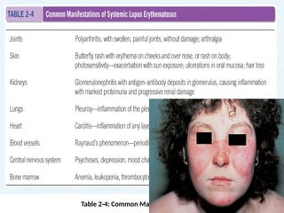 Table 2-4: Common Manifestations of SLE 31
 