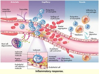 9
Inflammatory response.
 