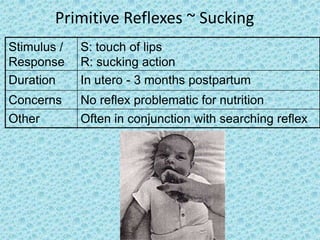 Primitive Reflexes ~ Sucking
Stimulus /   S: touch of lips
Response     R: sucking action
Duration     In utero - 3 months postpartum
Concerns     No reflex problematic for nutrition
Other        Often in conjunction with searching reflex
 