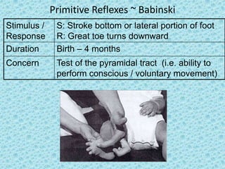 Primitive Reflexes ~ Babinski
Stimulus /    S: Stroke bottom or lateral portion of foot
Response      R: Great toe turns downward
Duration      Birth – 4 months
Concern       Test of the pyramidal tract (i.e. ability to
              perform conscious / voluntary movement)
 