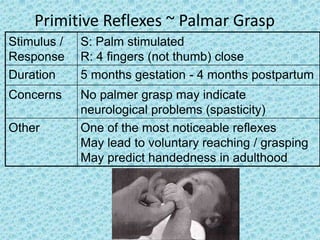 Primitive Reflexes ~ Palmar Grasp
Stimulus /   S: Palm stimulated
Response     R: 4 fingers (not thumb) close
Duration     5 months gestation - 4 months postpartum
Concerns     No palmer grasp may indicate
             neurological problems (spasticity)
Other        One of the most noticeable reflexes
             May lead to voluntary reaching / grasping
             May predict handedness in adulthood
 