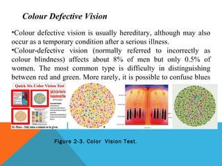 Chapter2hfam(human performance) | PPT | Eye and Vision Conditions ...