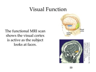 59
Visual Function
The functional MRI scan
shows the visual cortex
is active as the subject
looks at faces.
CourtesyofV.P.Clark,K.Keill,J.Ma.
Maisog,S.Courtney,L.G.
Ungerleider,andJ.V.Haxby,
NationalInstituteofMentalHealth
 