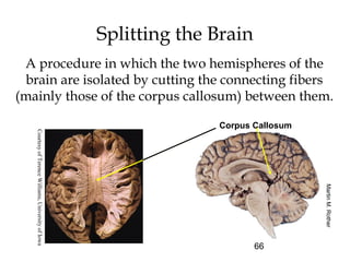 66
Splitting the Brain
A procedure in which the two hemispheres of the
brain are isolated by cutting the connecting fibers
(mainly those of the corpus callosum) between them.
Corpus Callosum
MartinM.Rother
CourtesyofTerenceWilliams,UniversityofIowa
 
