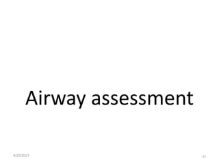 Airway assessment
4/22/2021 45
 
