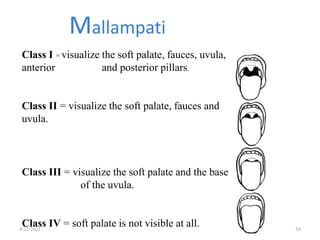 Class I = visualize the soft palate, fauces, uvula,
anterior and posterior pillars.
Class II = visualize the soft palate, fauces and
uvula.
Class III = visualize the soft palate and the base
of the uvula.
Class IV = soft palate is not visible at all.
Mallampati
4/22/2021 54
 