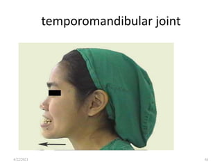 temporomandibular joint
61
4/22/2021
 