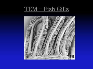 TEM – Fish Gills
 