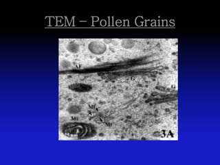 TEM – Pollen Grains
 