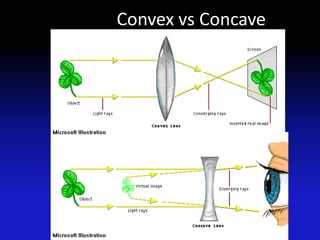 Convex vs Concave
 