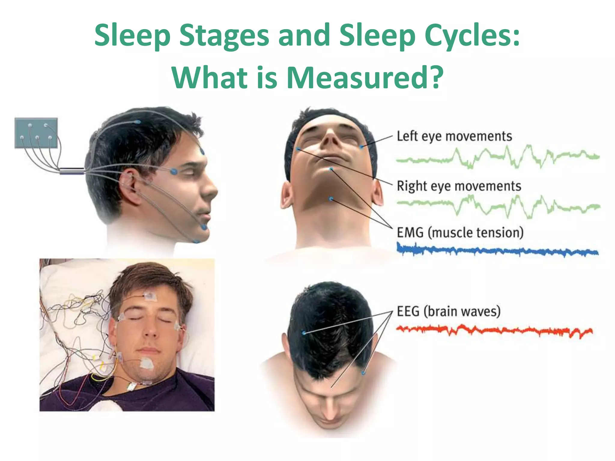 Sleep Stages and Sleep Cycles:
What is Measured?
 