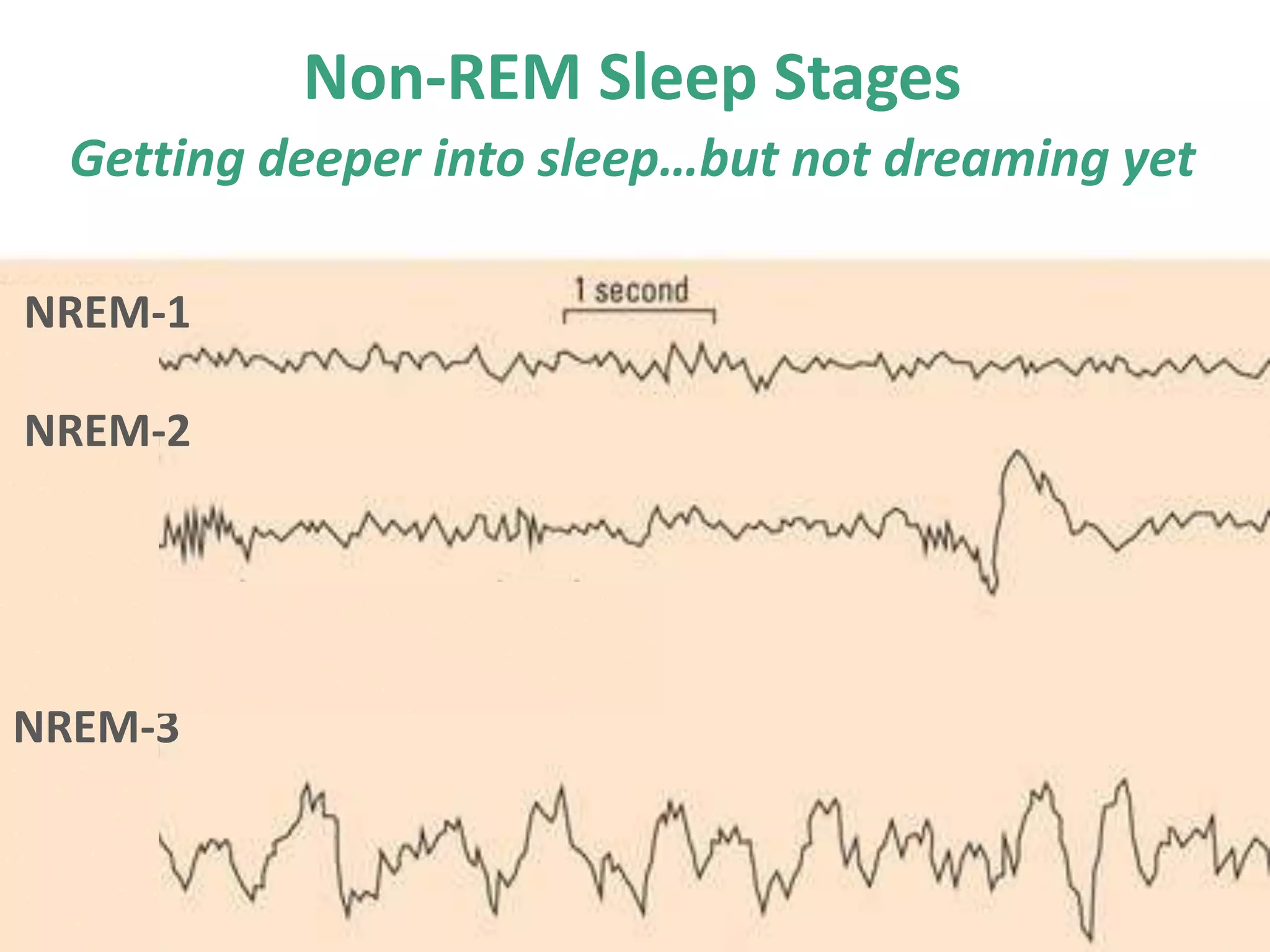 Non-REM Sleep Stages
Getting deeper into sleep…but not dreaming yet
NREM-1
NREM-2
NREM-3
 