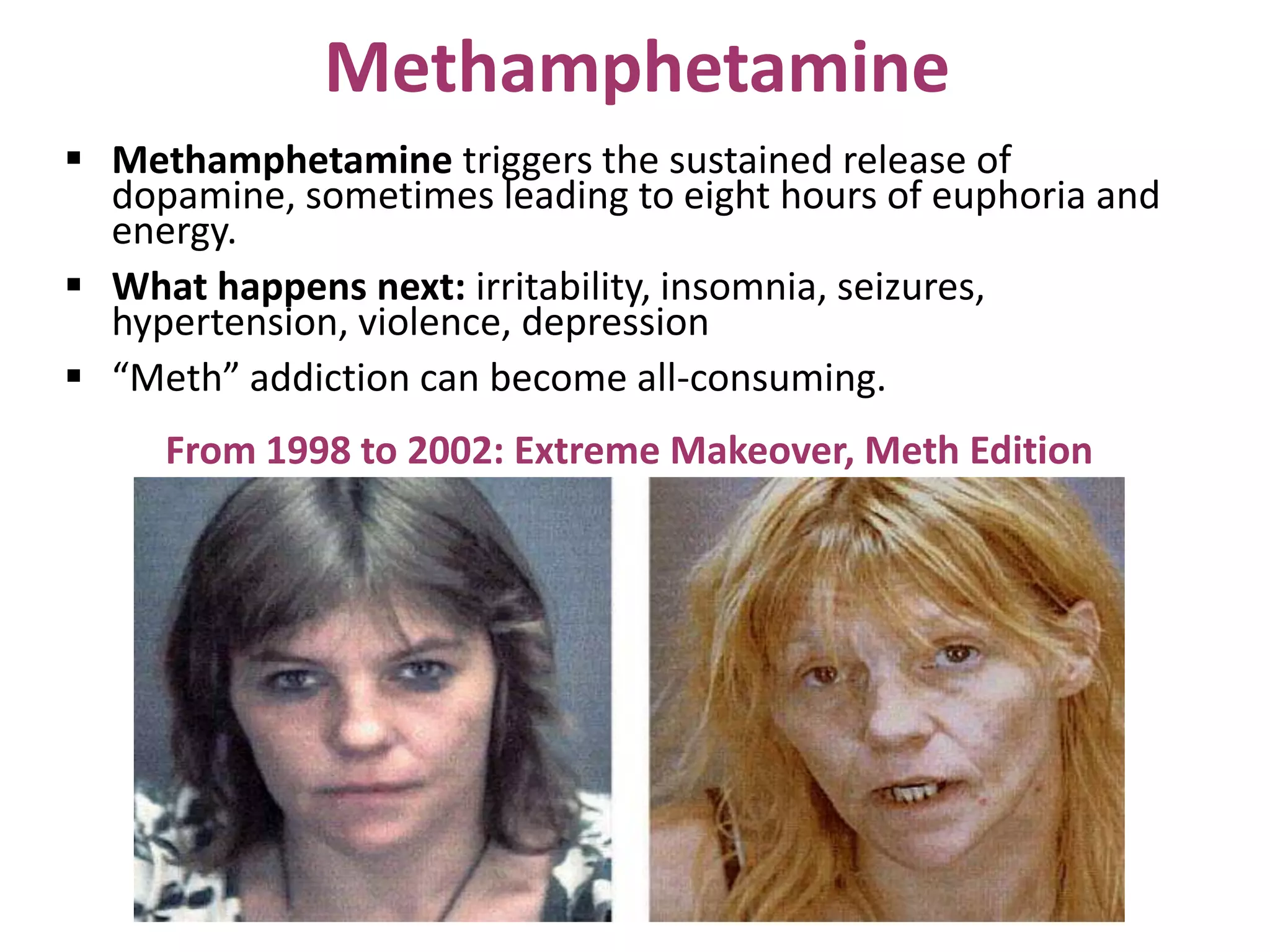 Methamphetamine
 Methamphetamine triggers the sustained release of
dopamine, sometimes leading to eight hours of euphoria and
energy.
 What happens next: irritability, insomnia, seizures,
hypertension, violence, depression
 “Meth” addiction can become all-consuming.
From 1998 to 2002: Extreme Makeover, Meth Edition
 