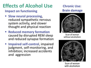 Effects of Alcohol Use
Impact on functioning
 Slow neural processing,
reduced sympathetic nervous
system activity, and slower
thought and physical reaction
 Reduced memory formation
caused by disrupted REM sleep
and reduced synapse formation
 Impaired self-control, impaired
judgment, self-monitoring, and
inhibition; increased accidents
and aggression
Chronic Use:
Brain damage
 