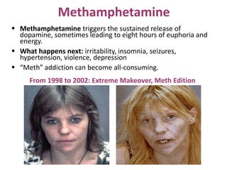 Methamphetamine
 Methamphetamine triggers the sustained release of
dopamine, sometimes leading to eight hours of euphoria and
energy.
 What happens next: irritability, insomnia, seizures,
hypertension, violence, depression
 “Meth” addiction can become all-consuming.
From 1998 to 2002: Extreme Makeover, Meth Edition
 
