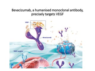 Bevacizumab, a humanised monoclonal antibody,
precisely targets VEGF
Bevacizumab
VEGF receptor
VEGF
 