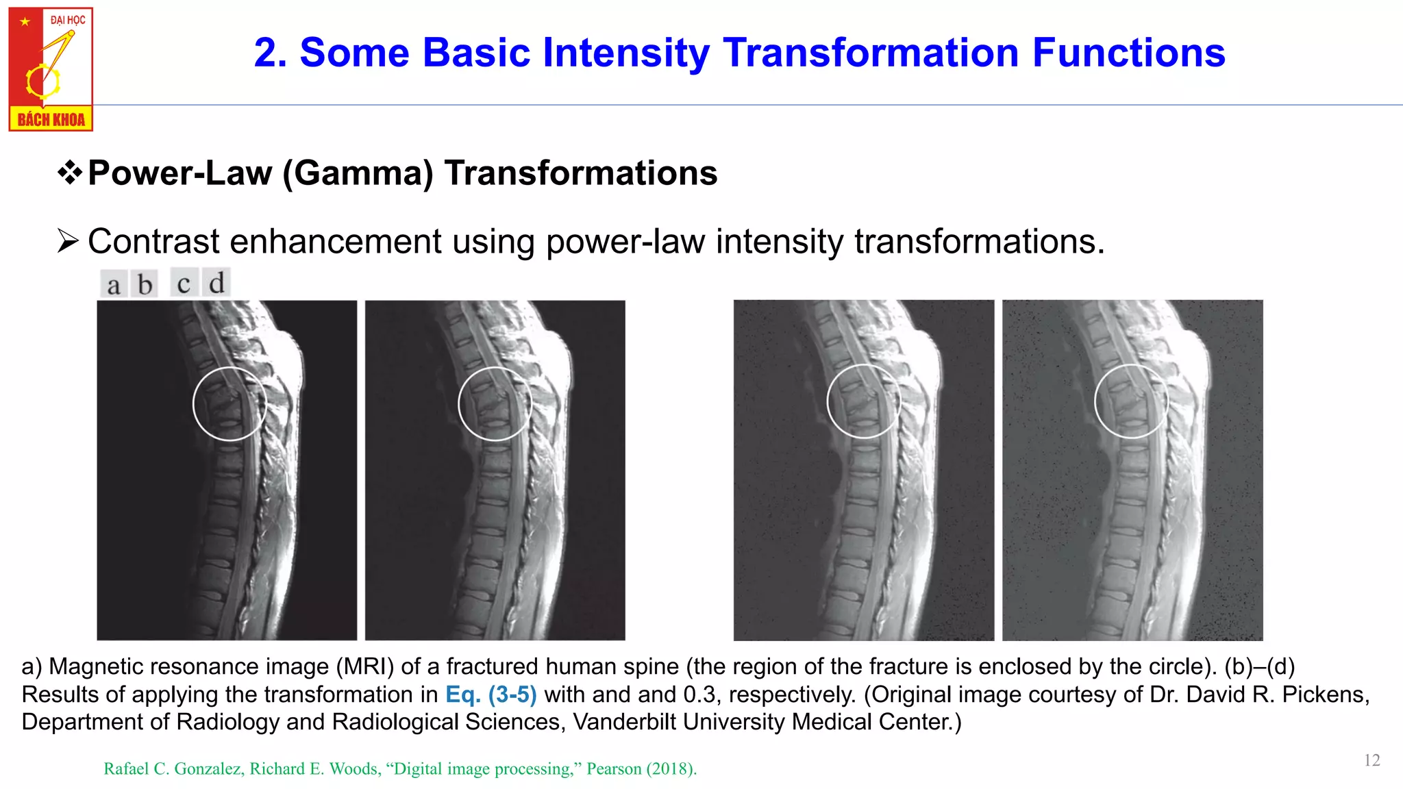 12
2. Some Basic Intensity Transformation Functions
❖Power-Law (Gamma) Transformations
➢Contrast enhancement using power-law intensity transformations.
Rafael C. Gonzalez, Richard E. Woods, “Digital image processing,” Pearson (2018).
a) Magnetic resonance image (MRI) of a fractured human spine (the region of the fracture is enclosed by the circle). (b)–(d)
Results of applying the transformation in Eq. (3-5) with and and 0.3, respectively. (Original image courtesy of Dr. David R. Pickens,
Department of Radiology and Radiological Sciences, Vanderbilt University Medical Center.)
 