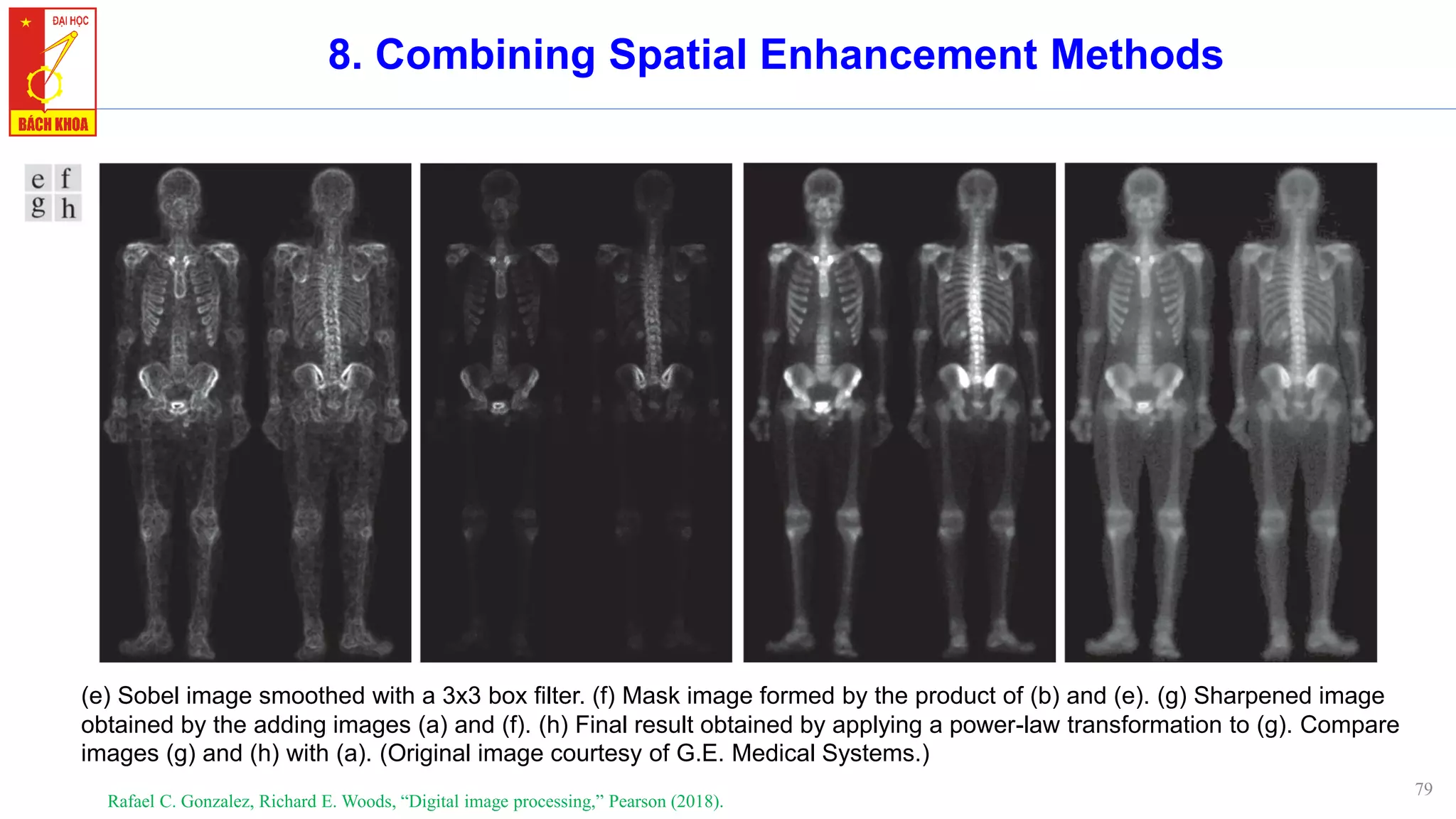 79
8. Combining Spatial Enhancement Methods
Rafael C. Gonzalez, Richard E. Woods, “Digital image processing,” Pearson (2018).
(e) Sobel image smoothed with a 3x3 box filter. (f) Mask image formed by the product of (b) and (e). (g) Sharpened image
obtained by the adding images (a) and (f). (h) Final result obtained by applying a power-law transformation to (g). Compare
images (g) and (h) with (a). (Original image courtesy of G.E. Medical Systems.)
 