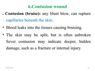 04/04/2025 21
6.Contusion wound
. Contusion (bruise): any blunt blow, can rupture
capillaries beneath the skin.
• Blood leaks into the tissues causing bruising.
• The skin may be split, but is often unbroken
Sever contusion may indicate deeper, hidden
damage, such as a fracture or internal injury.
 