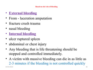 04/04/2025 30
Based on site/ site of bleeding
• External bleeding
• From - laceration amputation
• fracture crush trauma
• nasal bleeding
• Internal bleeding
• ulcer ruptured spleen
• abdominal or chest injury
• Any bleeding that is life threatening should be
stopped and controlled immediately.
• A victim with massive bleeding can die in as little as
2-3 minutes if the bleeding is not controlled quickly
 